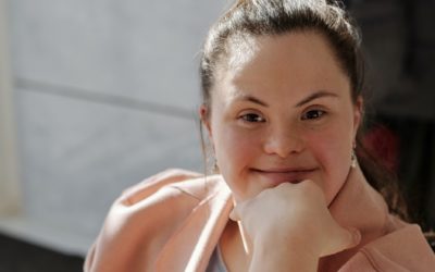 Σύνδρομο Down